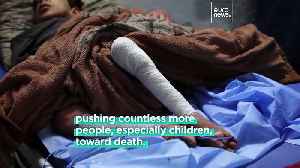Gaza's children are starving. What does malnutrition do to the human body? [Video]