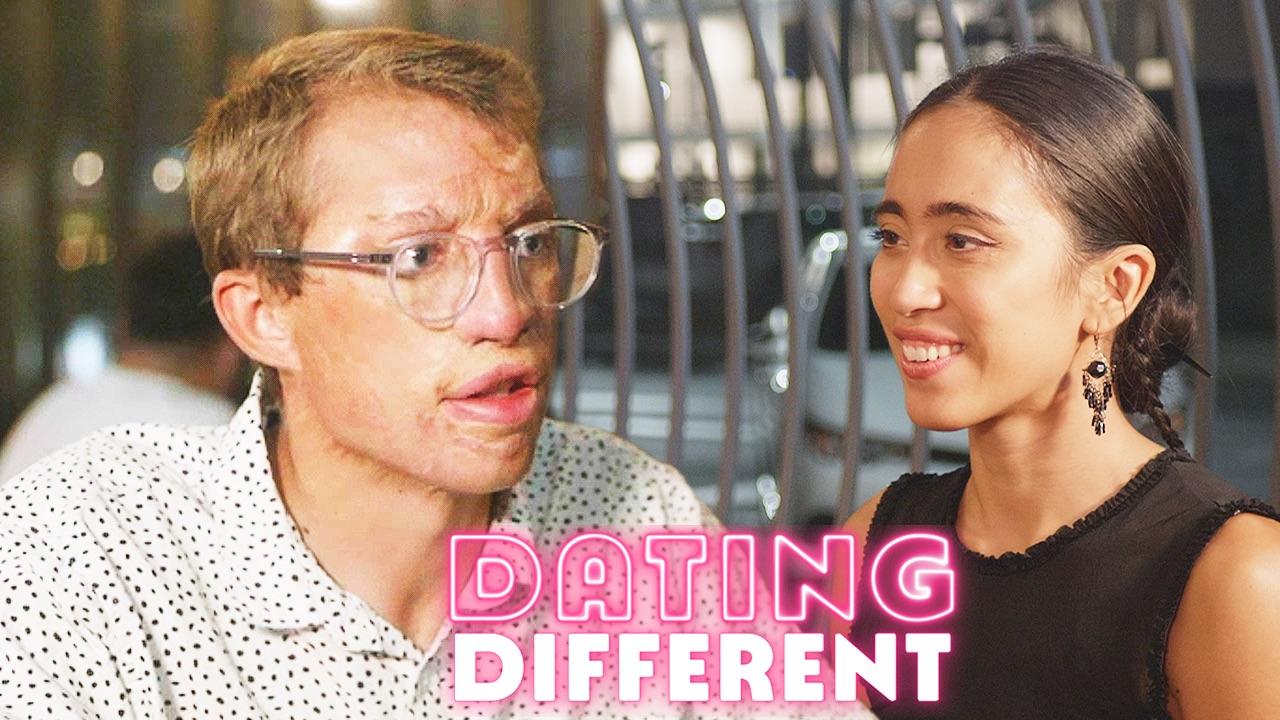 My Burns Stop Me Finding Love - Will My Blind Date Care? | DATING DIFFERENT