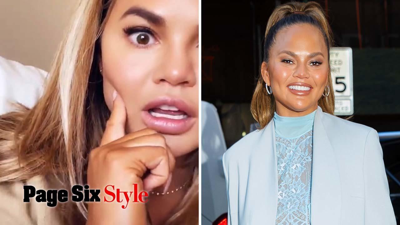 Chrissy Teigen reveals she had fat removed from her cheeks