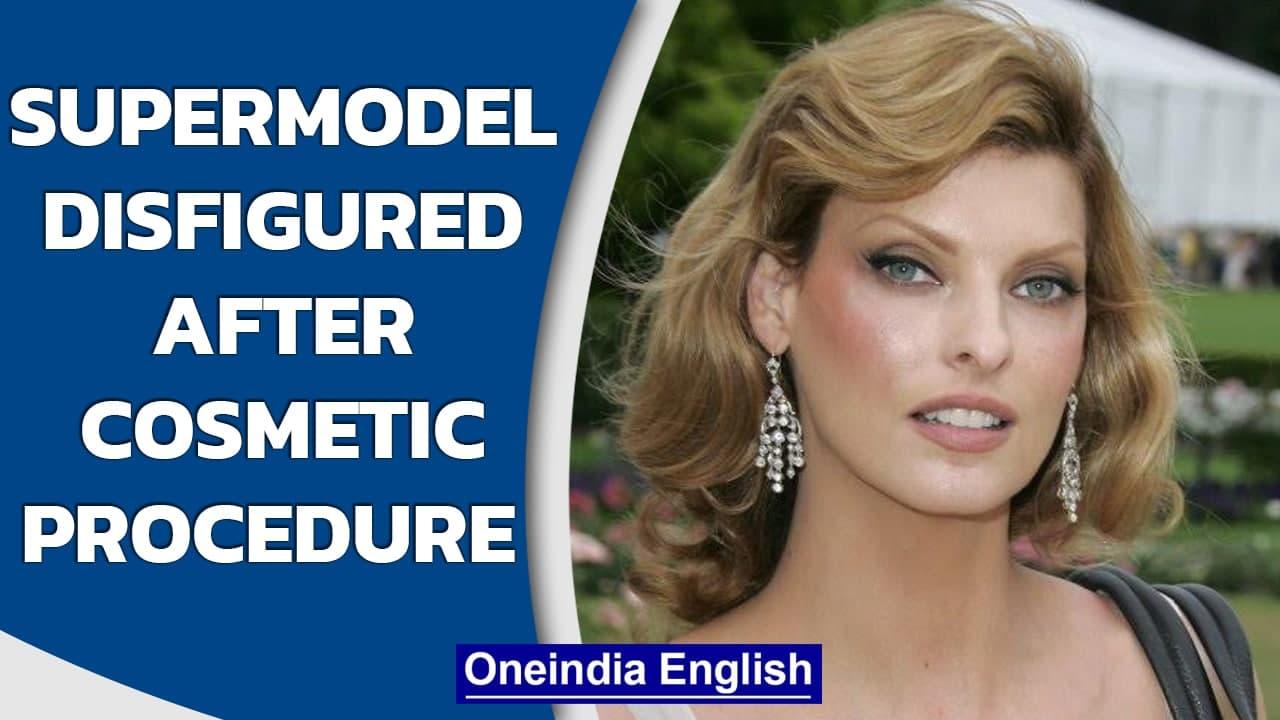 Supermodel 'brutally disfigured' after fat freezing procedure, claims $50 mn | Oneindia News