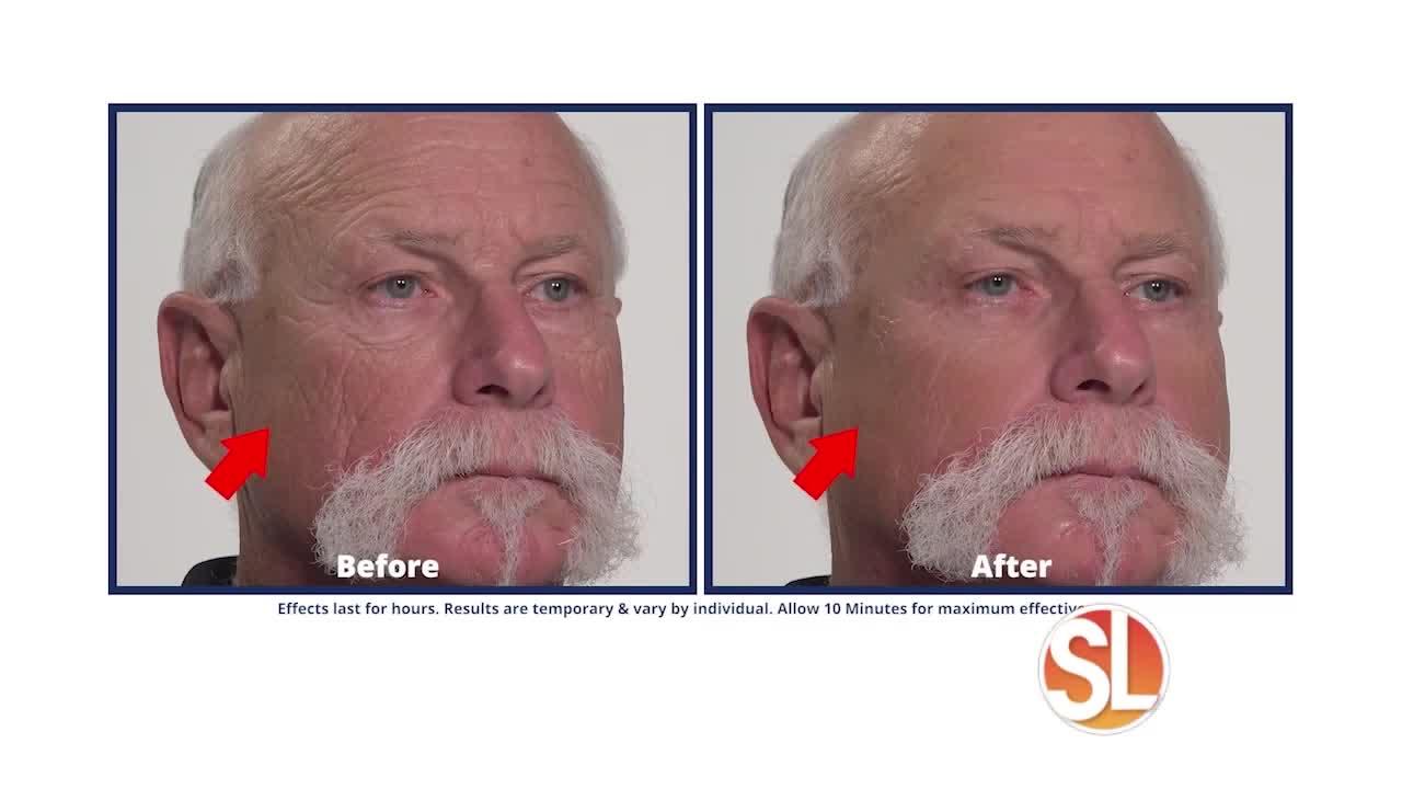 Look younger in just 10-minutes with Plexaderm
