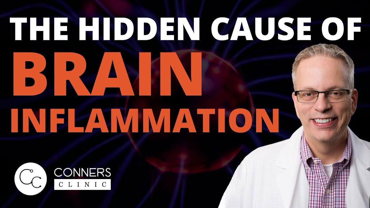 The Hidden Cause of Brain Inflammation Your Doctor Always Misses | Dr. Kevin Conners, Conners Clinic