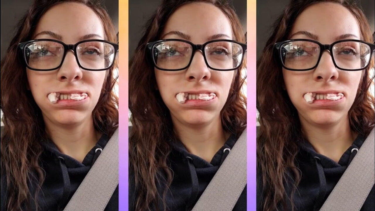 I Lost All My Teeth Aged 23 | BORN DIFFERENT