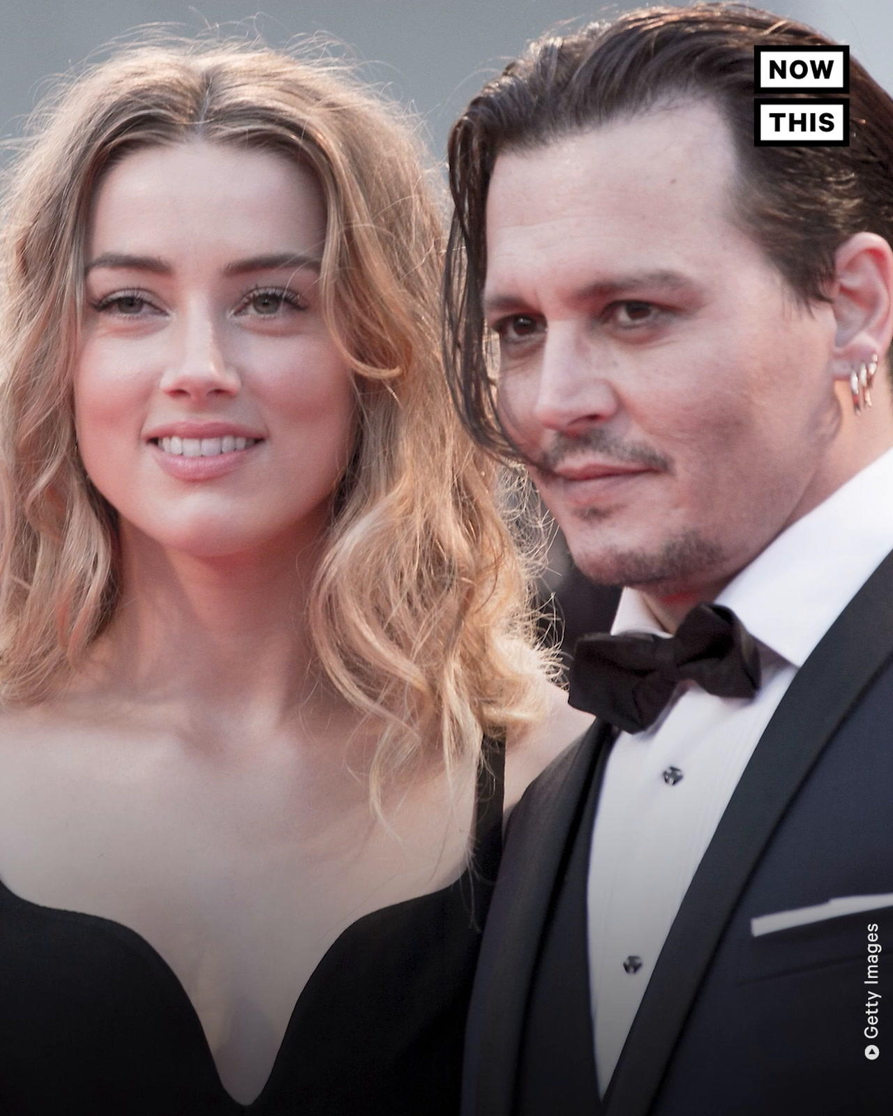 Amber Heard Is a Domestic Violence Survivor, Expert Says