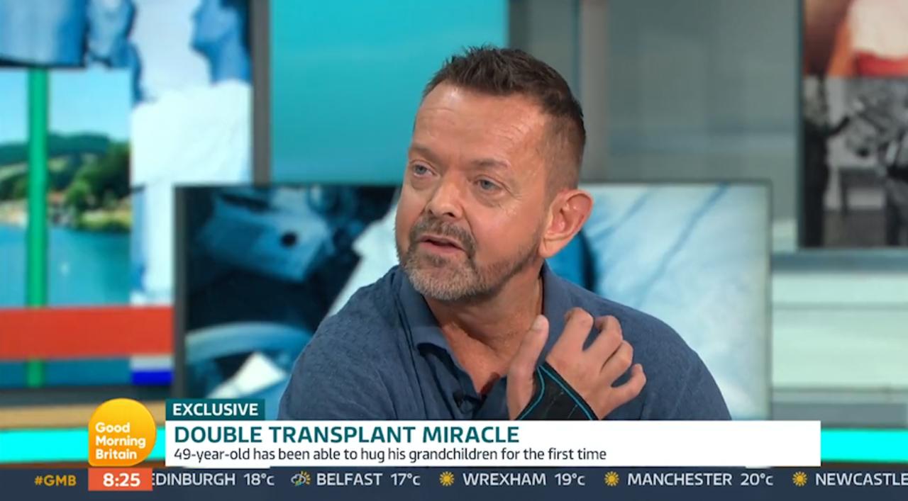 First person in the world to have a double arm and shoulder transplant appears on GMB