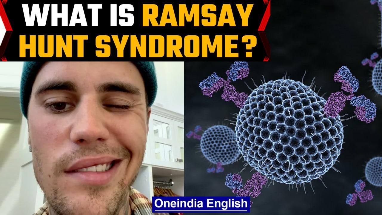What has Justin Bieber been diagnosed with? | Know about Ramsay Hunt syndrome | Oneindia News *news
