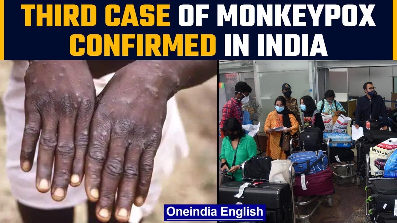Kerala: Third case of Monkeypox confirmed in the state, screening increased | Oneindia news *News