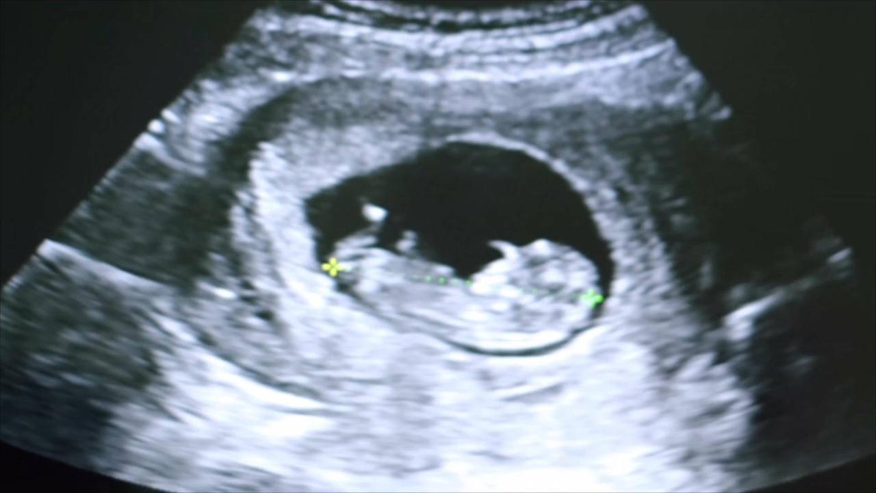 Georgia Rules Embryos Can Now Be Listed As Dependents on Tax Returns