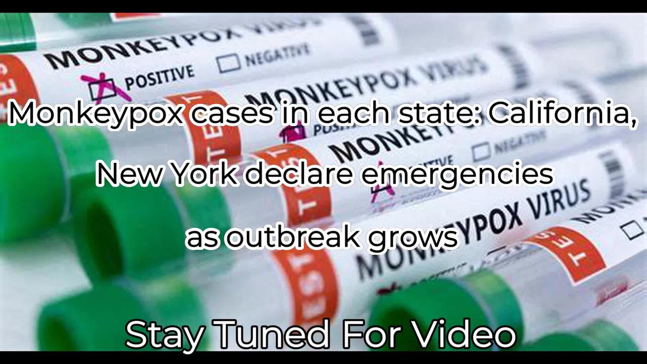 Monkeypox cases in each state: California, New York declare emergencies as outbreak grows