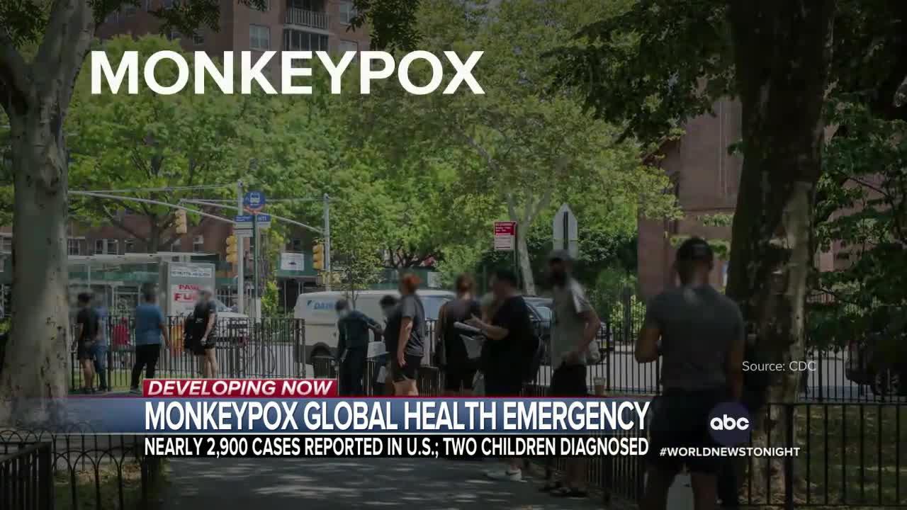 WHO declares monkeypox a ‘public health emergency’ | WNT