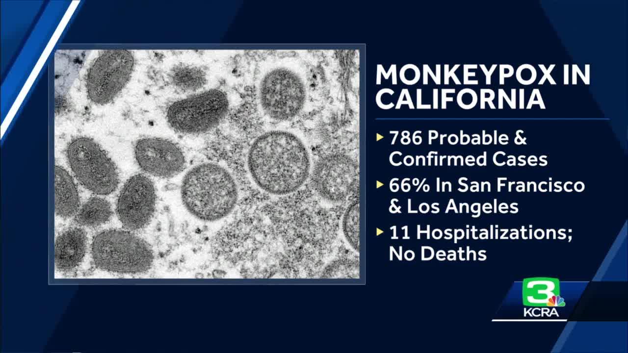 California health official says monkeypox state of emergency is still being considered