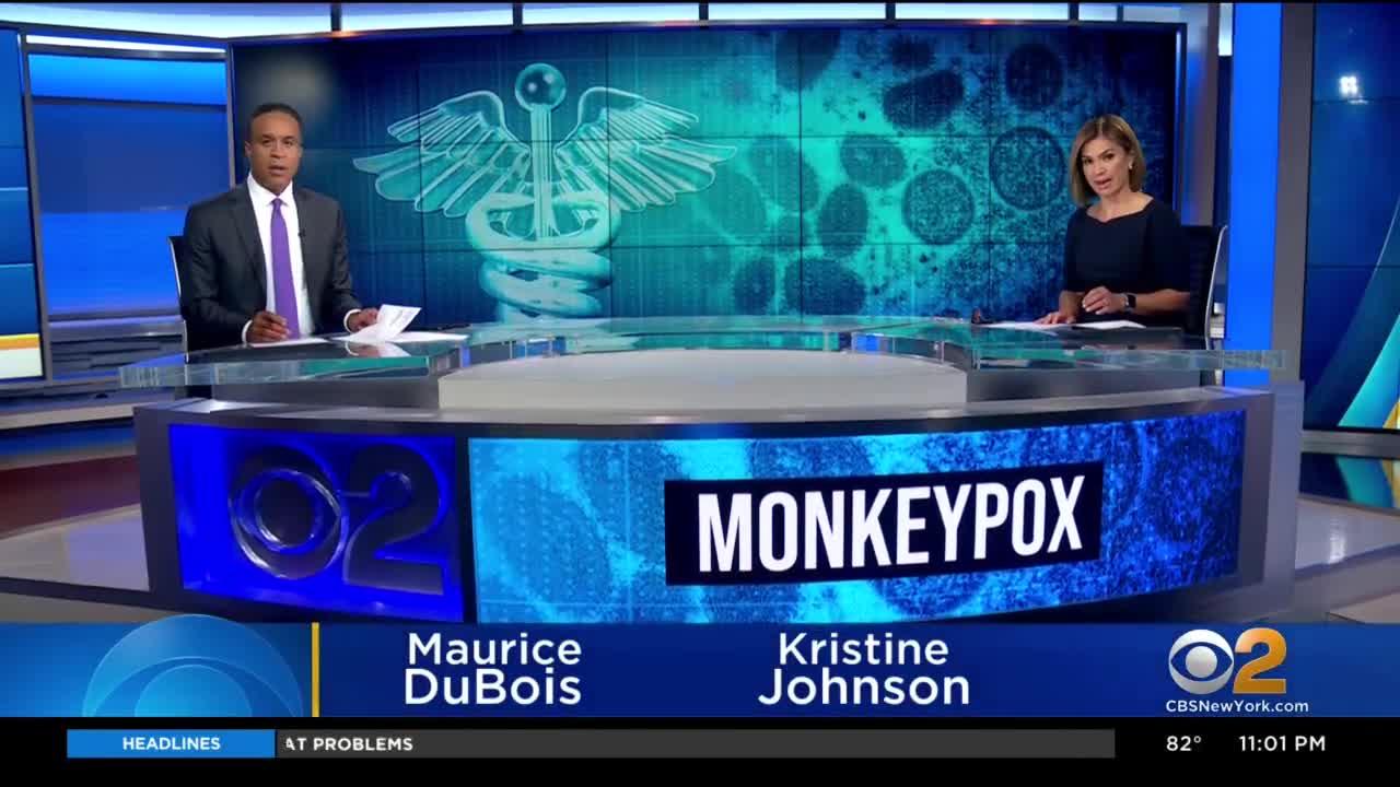 NYS health department declares monkeypox outbreak an imminent threat