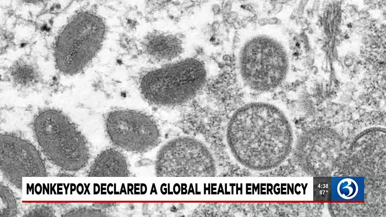 INTERVIEW: Monkeypox declared a global health emergency