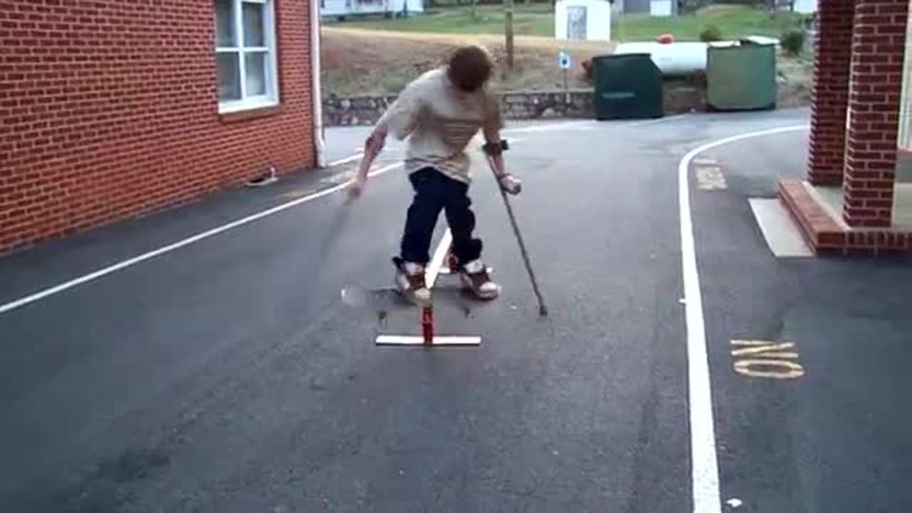 kid on crutches skateboards better than you