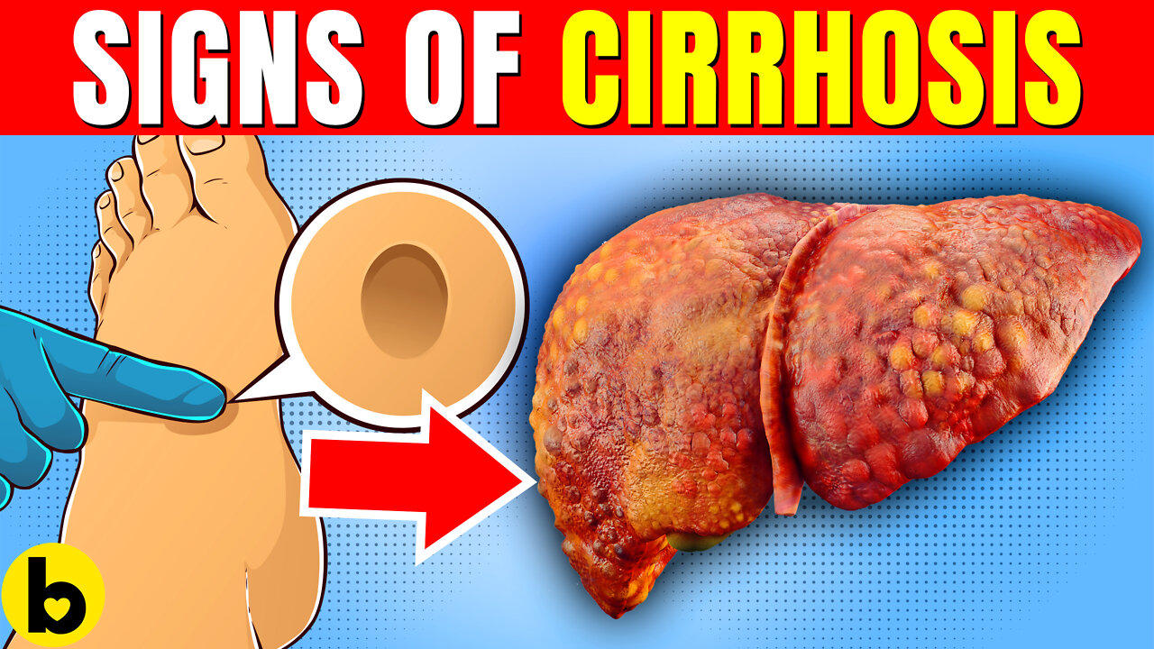 8 Warning Signs Of Cirrhosis You Need To Know