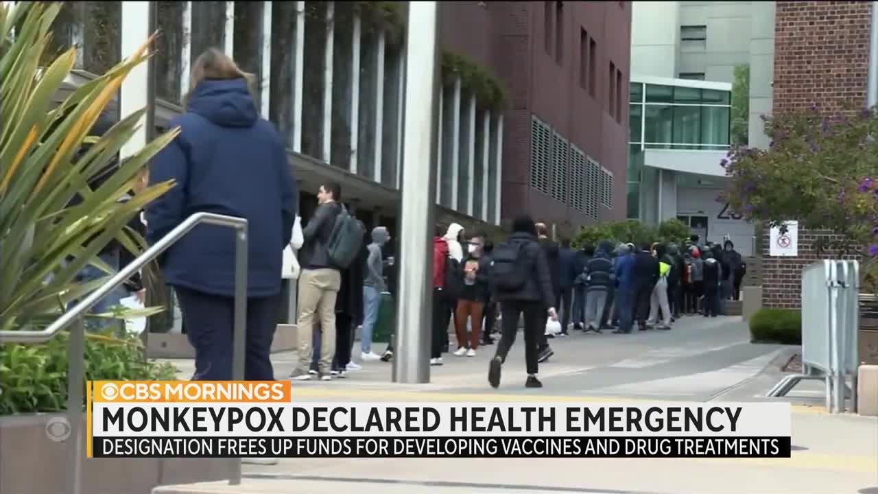 Monkeypox declared a public health emergency as virus spreads nationwide