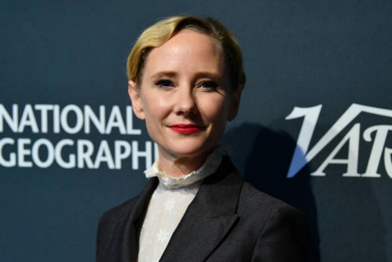 Anne Heche Dead at 53 From Injuries Sustained in Fiery Car Crash