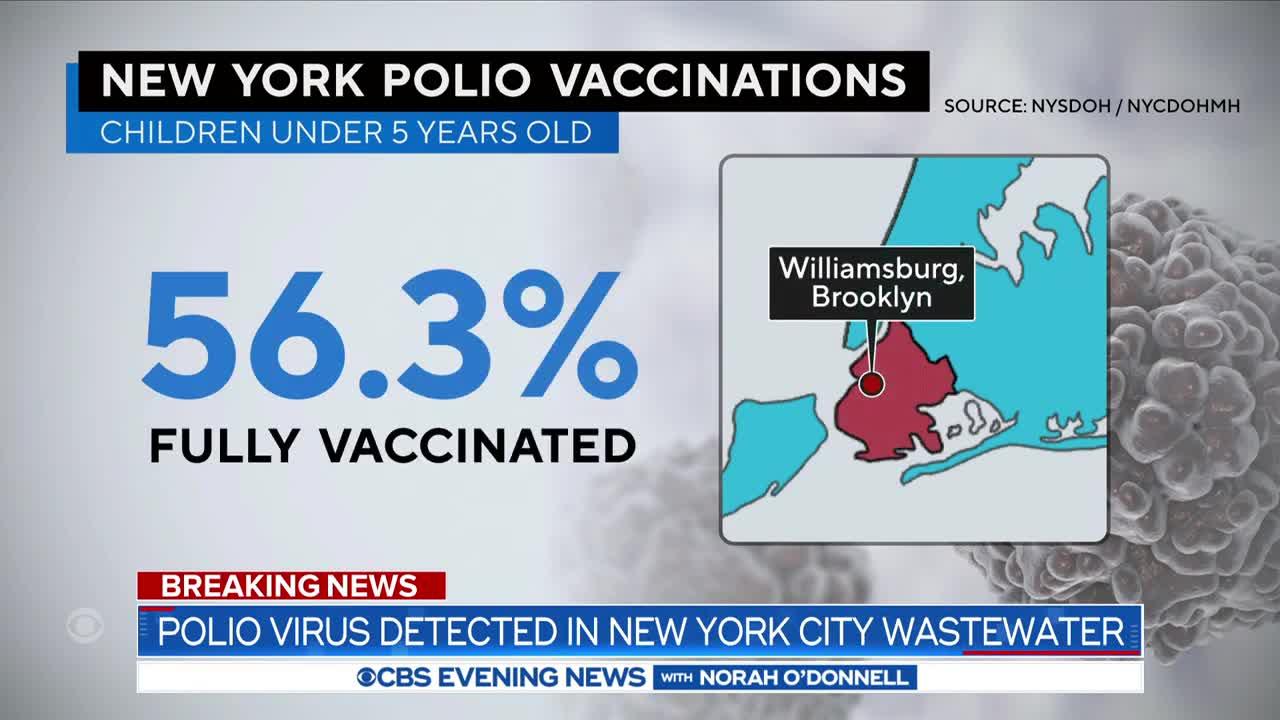 Polio detected in New York City wastewater