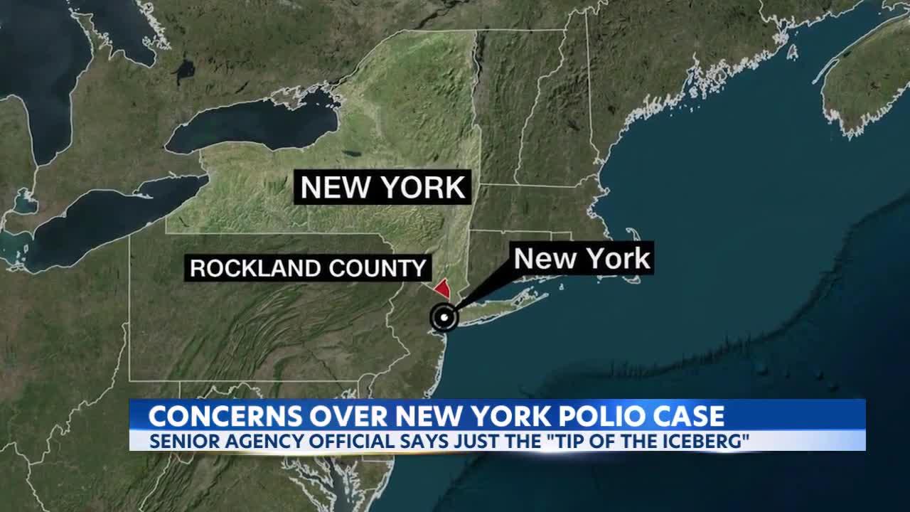 Polio detected in wastewater samples in NYC