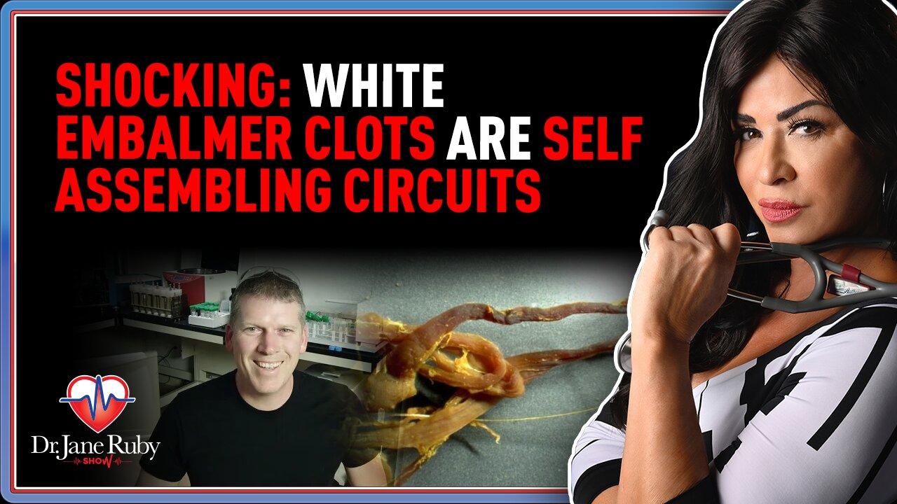 LIVE @7PM: SHOCKING: White Embalmer Clots Are Self Assembling Circuits