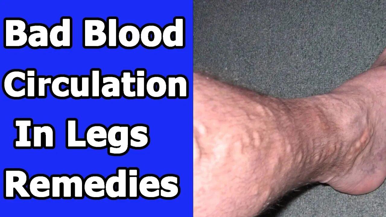 Home Remedies For Blood Circulation In Legs