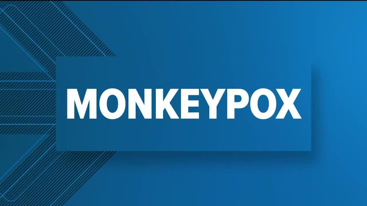 Monkeypox vaccine maker pushes back on FDA plan to split doses