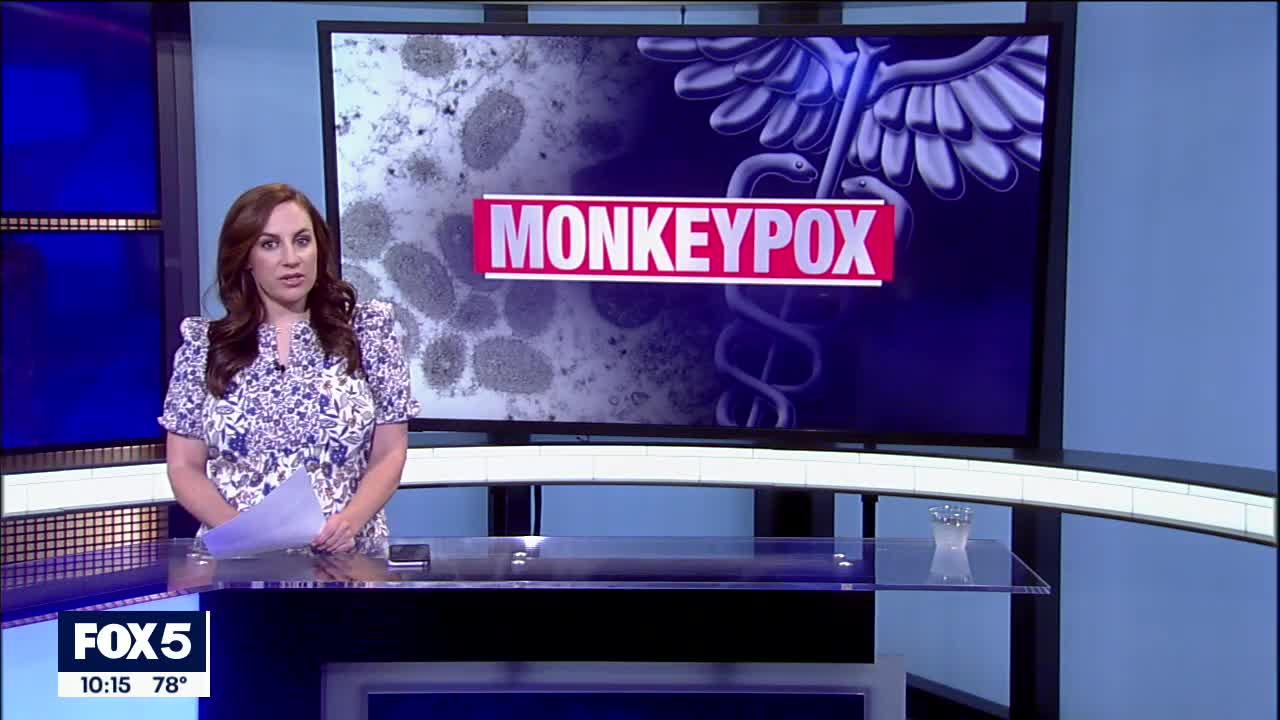 Experts: Monkeypox can spread to anyone through close contact