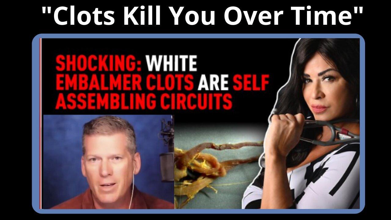 White Embalmer Clots Are Self Assembling Circuits, Thought Control Shots & More