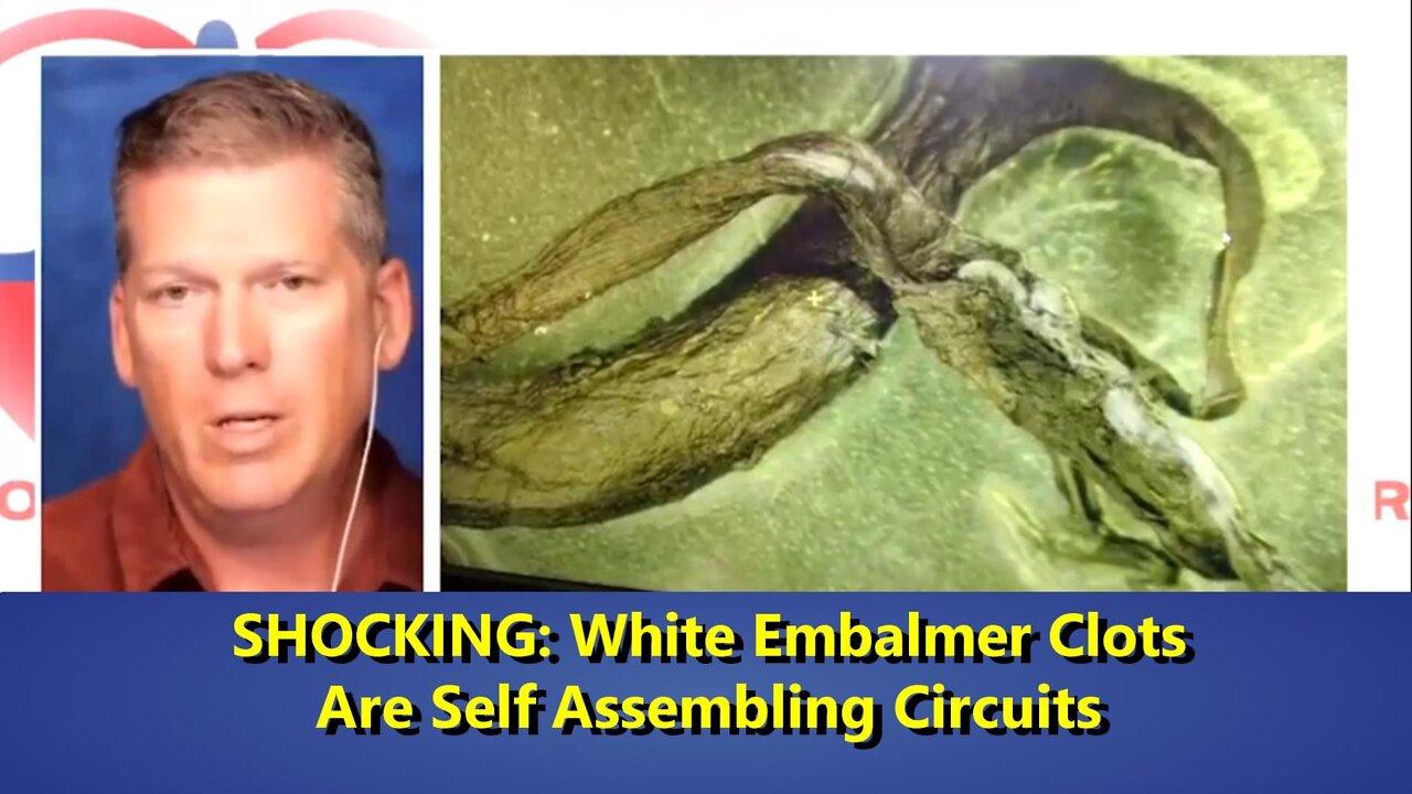 SHOCKING  White Embalmer Clots Are Self Assembling Circuits Plus THE MRNA INJECTION CULLING.