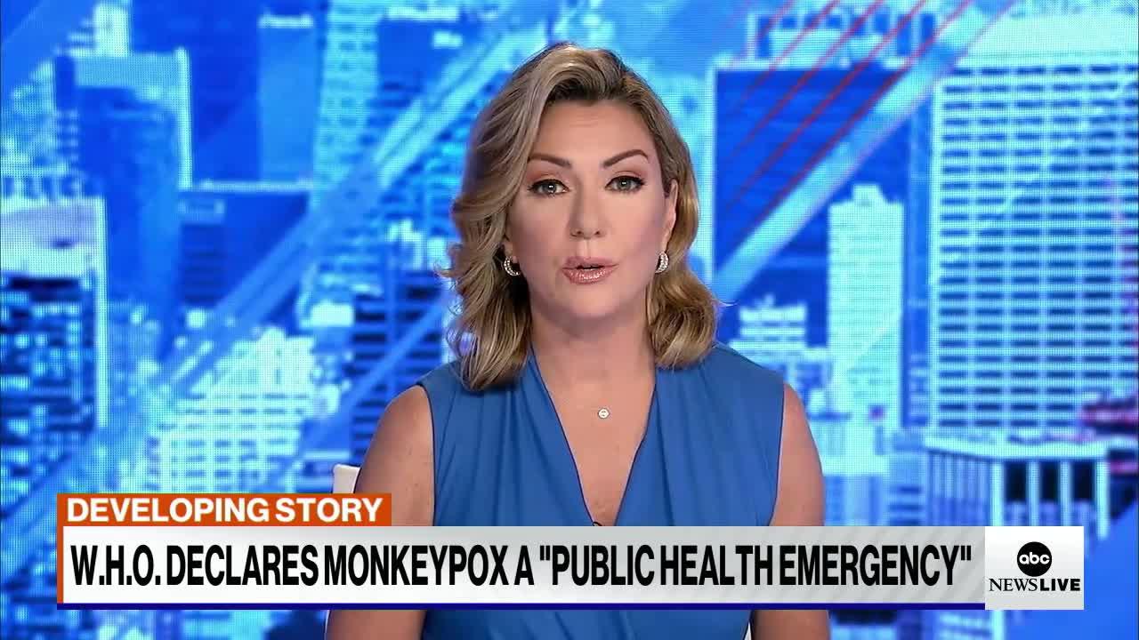 World Health Organization declares Monkeypox outbreak a 'public health emergency'