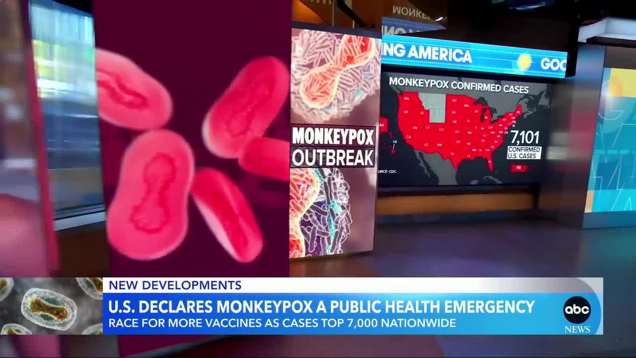 US declares monkeypox a public health emergency l GMA