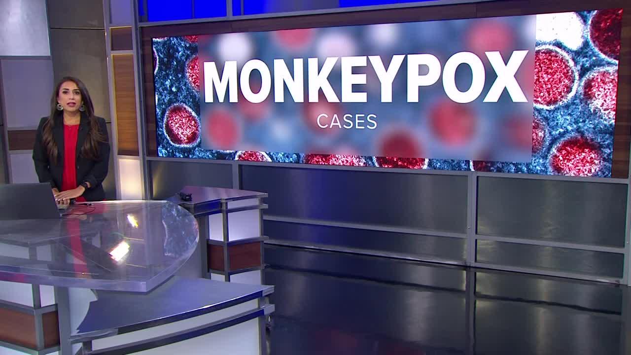 U.S. officials: Monkeypox is a public health emergency