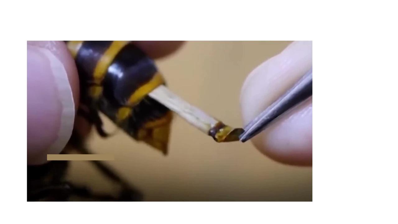surgery on giant ‘murder hornet’