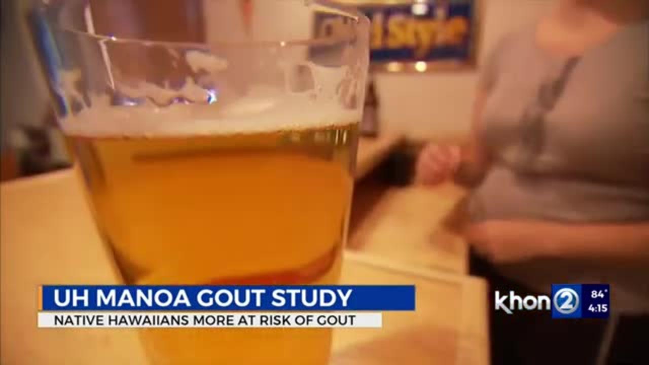 UH study reveals Native Hawaiians have twice the risk for gout