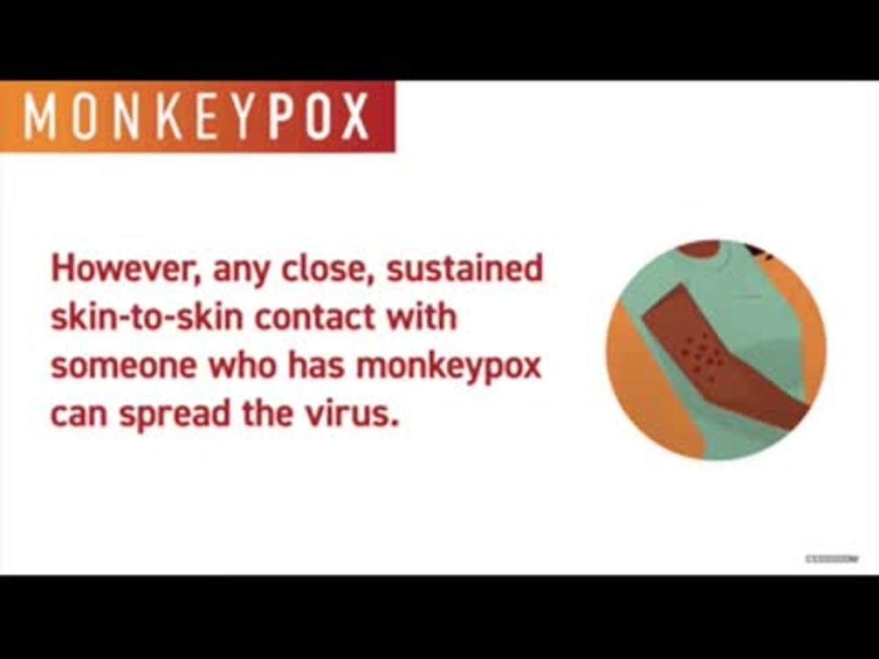 CDC Monkey pox