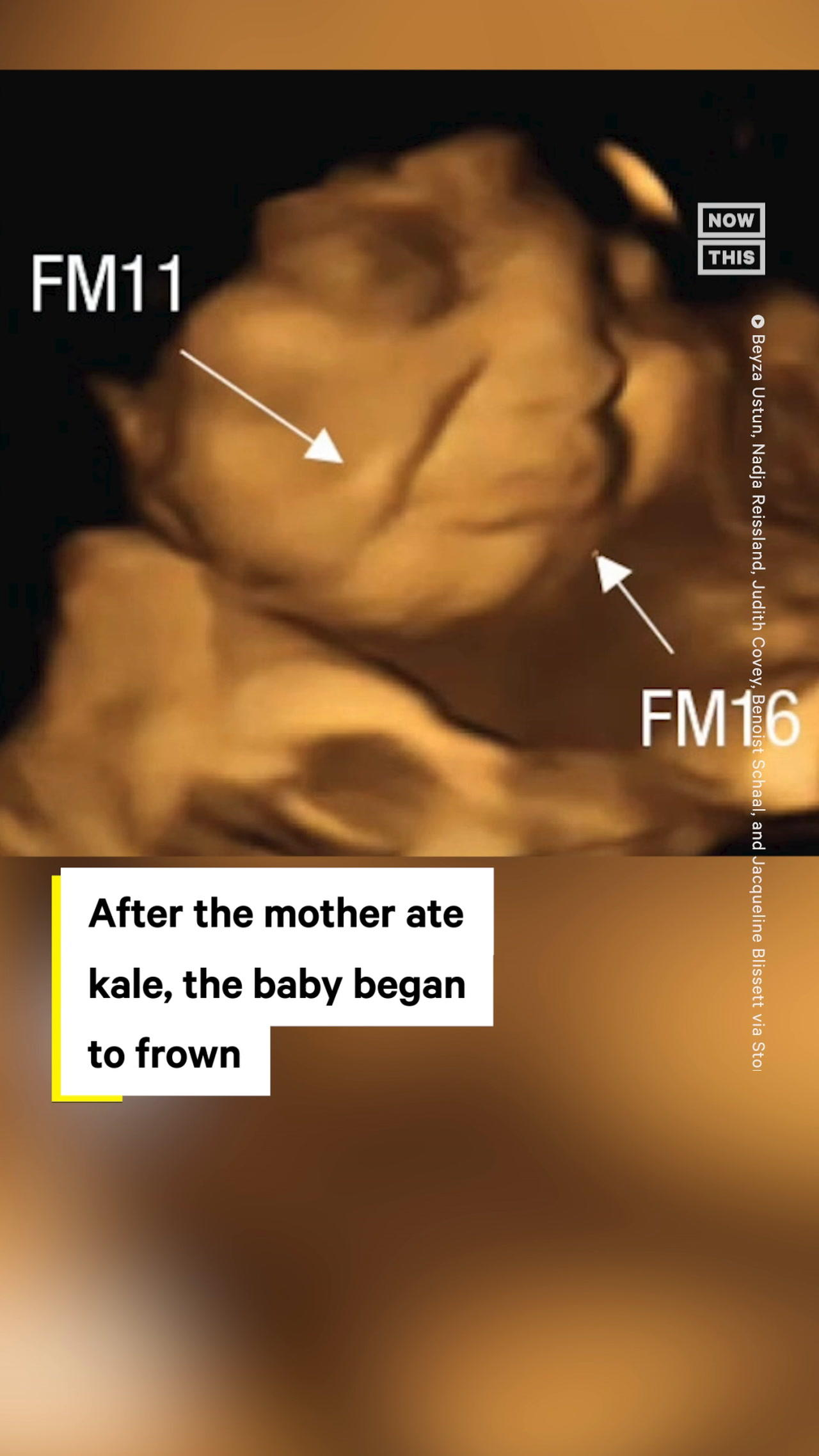 Babies in the Womb React to the Foods Mom Eats, Study Shows