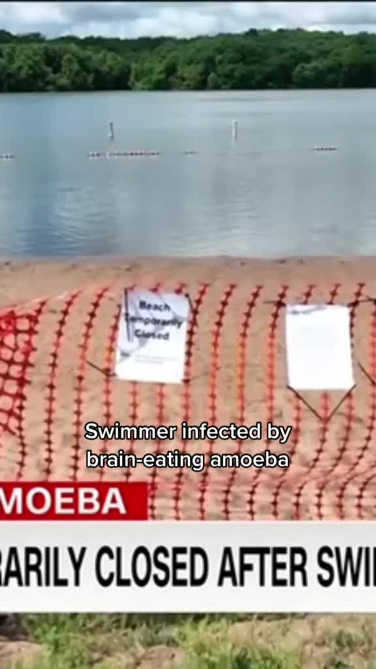 Swimmer infected by brain-eating amoeba