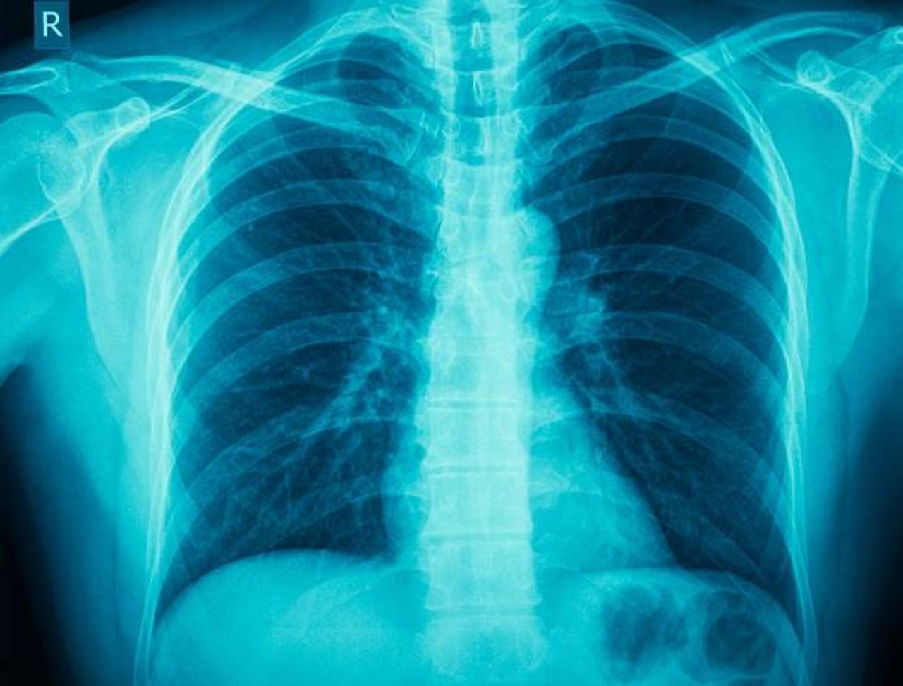 This Day in History: German Scientist Discovers X-Rays