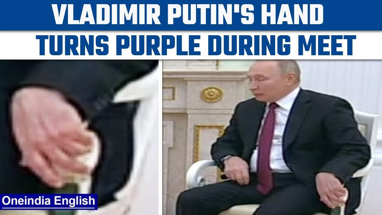 Vladimir Putin's health back under limelight after his hand reportedly turns purple | Oneindia News