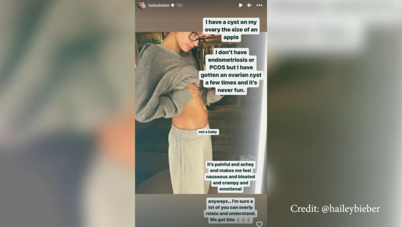 Hailey Bieber Reveals She Has A ‘Painful’ Ovarian Cyst In Detailed Social Media Posts