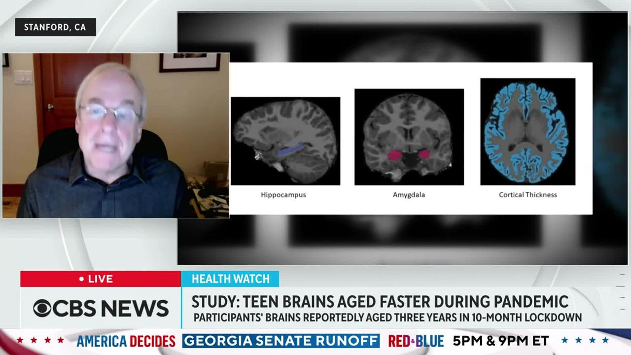 Teens' brains aged faster during the pandemic, study shows