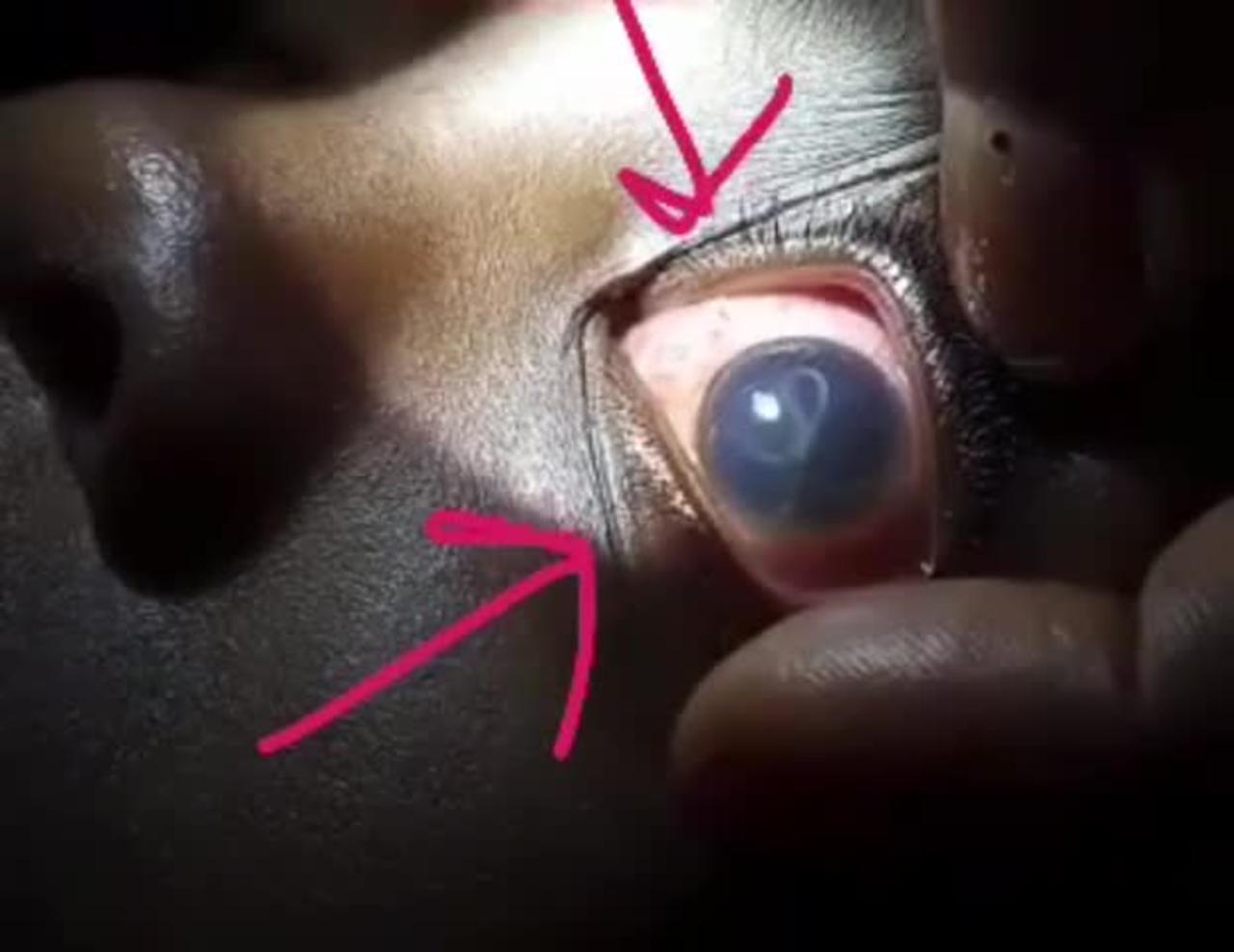 How a Parasite Looks Through a Kid's Eye - SCARY
