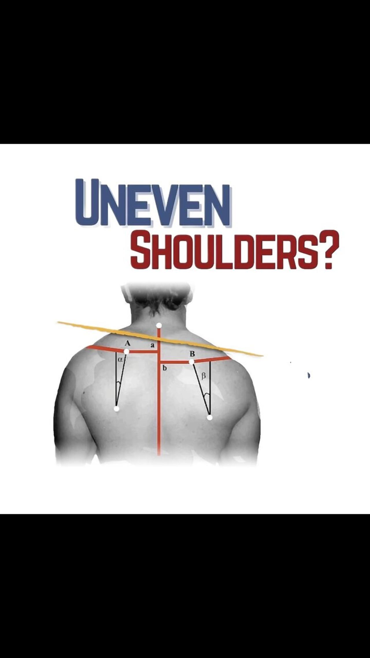 Uneven Shoulders Correction One News Page VIDEO