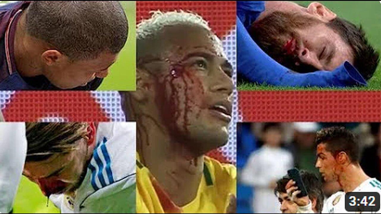 Top 5 Blood Injuries | Lionel Messi | Cristiano Ronaldo | Neymar Jr | Kylian MBappe | Sergio Ramos