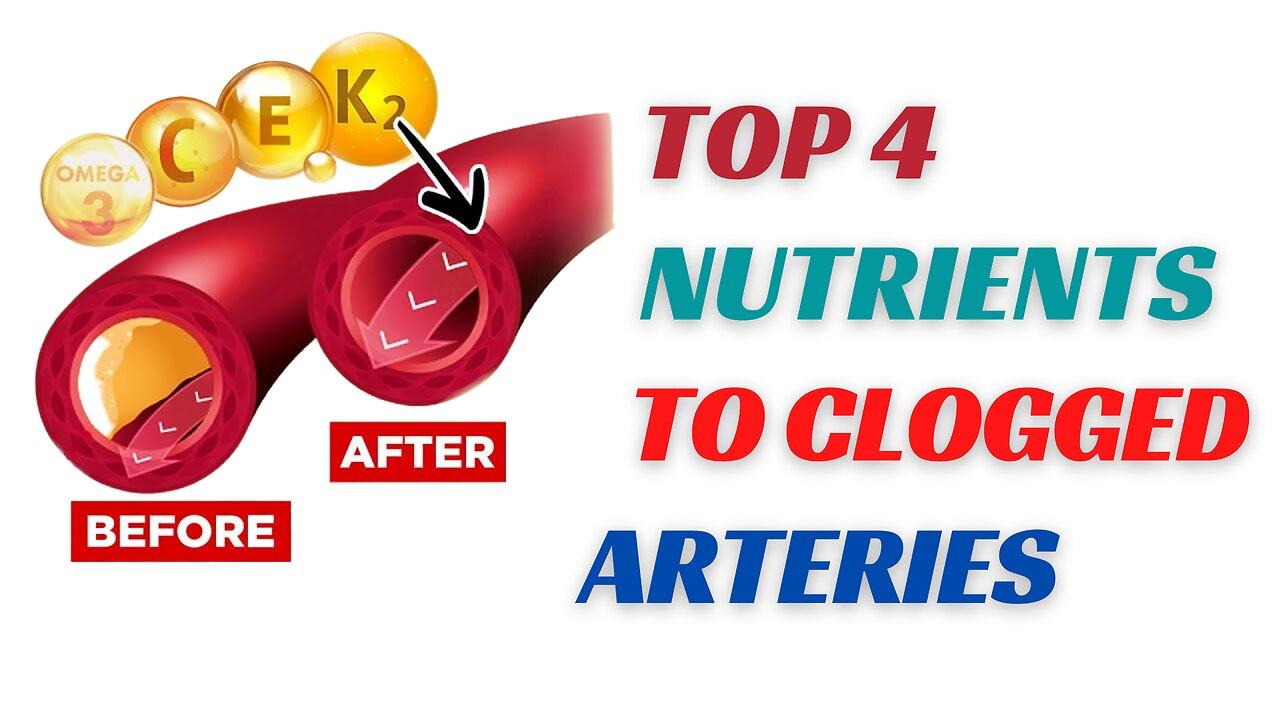 HOW TO UNCLOG YOUR ARTERIES NATURALLY TOP 4 One News Page VIDEO