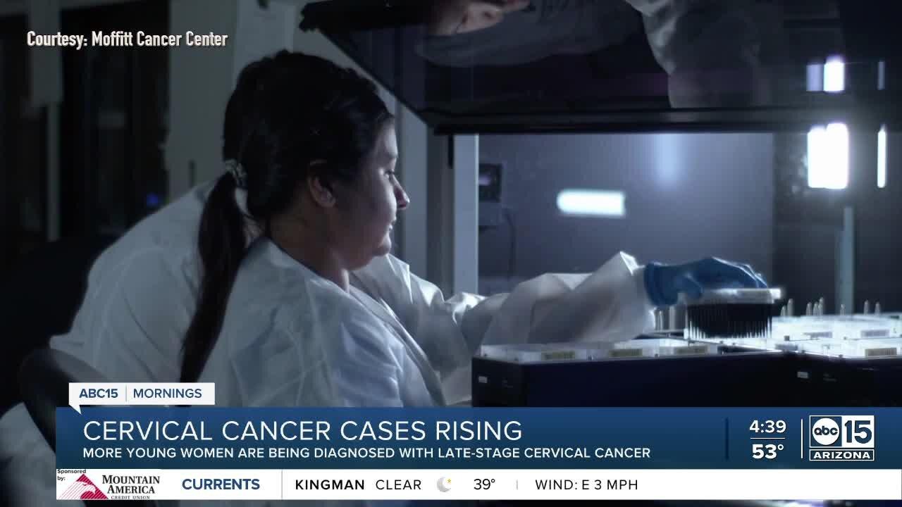 Cervical cancer cases rising among young women - One News Page VIDEO