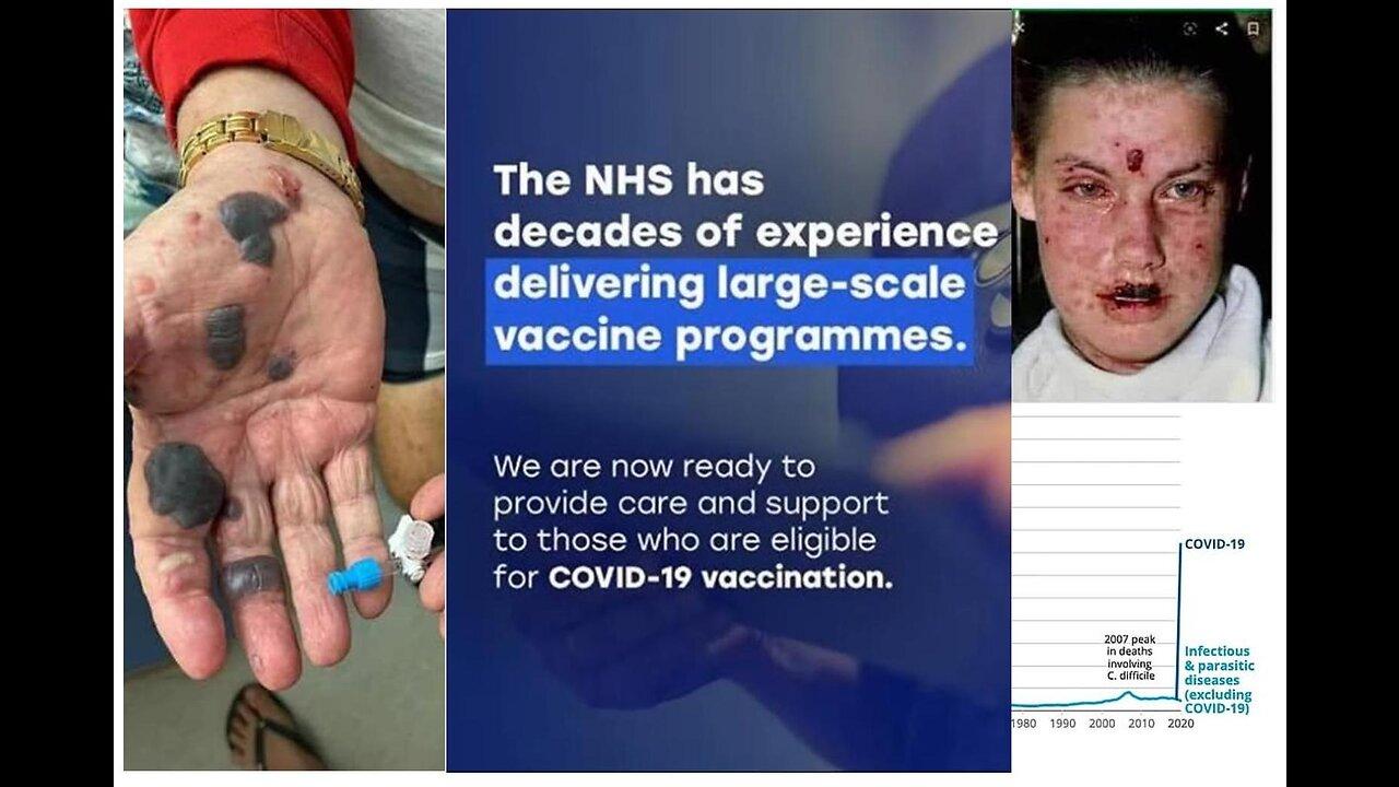 Food for Thought - Are the covid vaccines indeed 'SAFE AND EFFECTIVE"?! March 2021