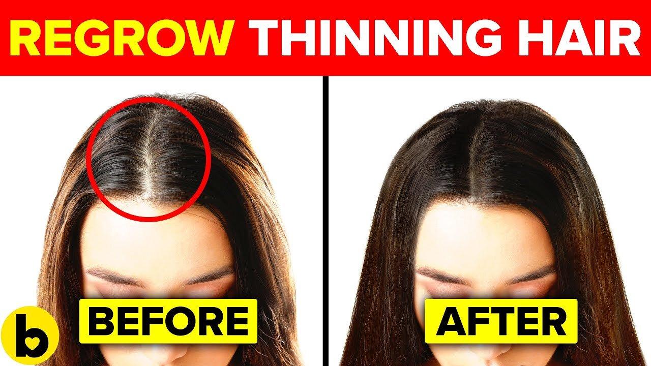 13 Ways To Regrow Your Hair Naturally And One News Page VIDEO