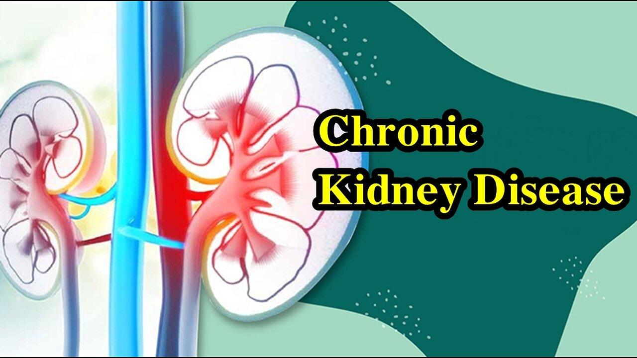 Chronic Kidney Disease: A Guide For Patients - One News Page VIDEO