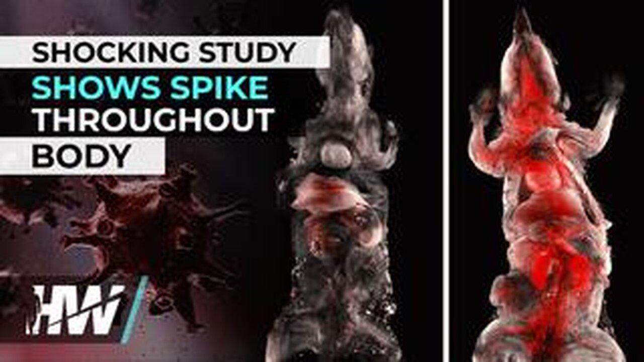 SHOCKING STUDY SHOWS SPIKE THROUGHOUT BODY One News Page VIDEO